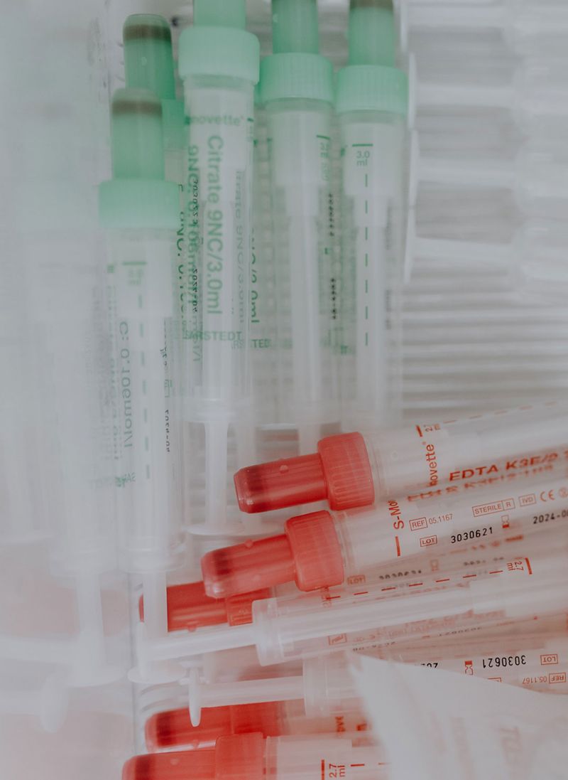 Blutuntersuchung in Frankfurt Wechseljahre